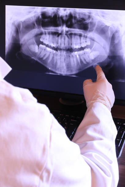 Best Emergency Tooth Extraction in Honeyville, UT