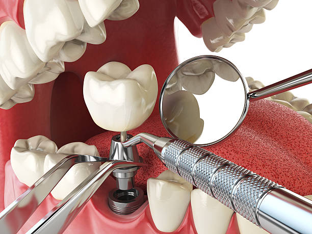 Best Emergency Treatment for Toothache in Honeyville, UT